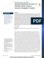 Guided Endodontic Access in A Maxillary Molar Using A Dynamic Navigation System