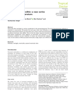 Neonatal Ventriculitis - A Case Series and Review of Literature