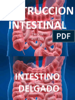 Obstruccion Intestinal Delgado-Grueso