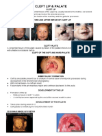 Cleft Lip & Palate