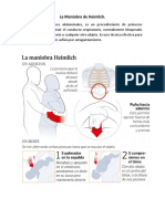 La Maniobra de Heimlich