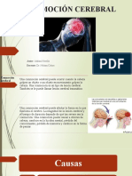 Conmoción Cerebral