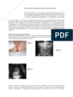 18-Month-Old Boy With Abdominal Pain and Rectal Bleeding Background