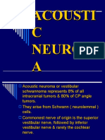 Acoustic Neuroma