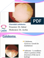 Choroidal Coloboma: Presenter:Dr. Rahul Moderator: Dr. Archis