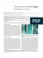 Traumatic Lumbosacral Spondylolisthesis: A Case Report: Shujie Tang