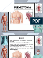 ESPLENECTOMIA