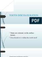 Teeth Discoloration