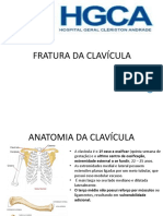 Fratura Da Clavícula