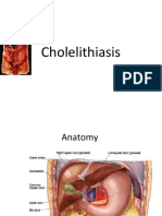 Colilithiasis 2