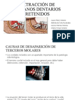 Extracción de Od Retenidos