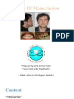 Class III Malocclusion