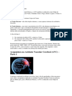 Acupuntura No Avc - Facilitando A Acupuntura