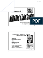 6 Middle Facial Fractures