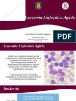 Caso Clinico Leucemia Linfocitica Aguda