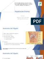 Hepatocarcinoma