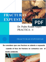 Practica Fracturas Expuestas