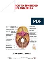 Approach To Sphenoid Sinus and Sella