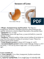 Diseases of Lens