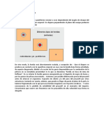 001 Lesiones Causadas Por Un Proyectil Unico