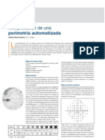 Interpretación de Una Perimetría Automatizada - CNOO