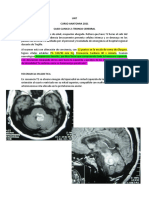 Caso Clinico Neuro - Upao