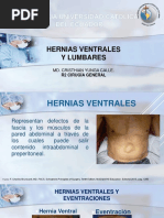 Hernias