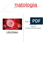 LEUCEMIA