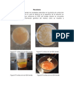 Discusión de Resultados de La Extracción de ADN