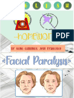 Facial Paralysis