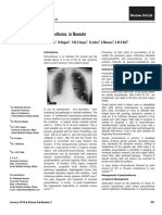Pneumothorax in Neonate: M Hassan, M Begum, S M Z Haque, N Jahan, A Mannan, Awsrob