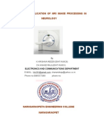 Neurology: Clinical Application of Mri Image Processing in