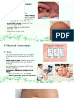 F. Physical Assessment: 5. Eyes