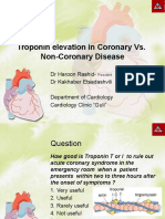 Troponin Elevation in Normal Coronaries