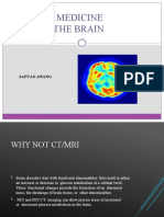 Nuclear Medicine of The Brain: Safuan Awang