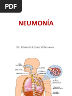 1 Neumonias