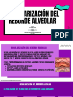 Regularización Del Reborde Alveolar