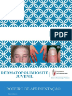 Dermatomiosite Juvenil