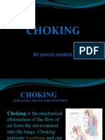 Choking: by Jawad Ahmed