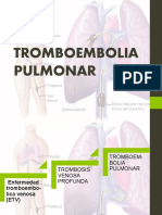 Tromboembolia Pulmonar