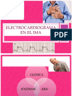 Ekg en IMA