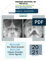 Infografía Artropatías