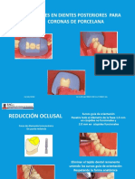 Preparaciones en Dientes Posteriores Acualizado 2020