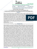 Irjmets - Analysis of Diabetic Retinopathy in Fundus Images Using CNN