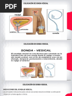 Clase 3 Colocación Sonda Vesical