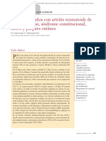 06.012 Caso Clínico. Mujer de 65 Años Con Artritis Reumatoide de Larga Evolución, Síndrome Constitucional, Fiebre y Púrpura Cutánea