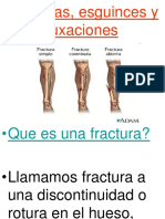 Fracturas - Esguinces y Luxaciones