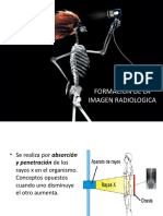 Formación de La Imagen Radiologica