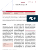 Implant-Supported Overdentures: Part 2: Clinical