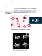 Significance of Echinocytosis in Blood Smears